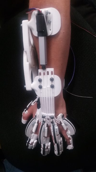 Unikat-Orthese-Hand-Exoskelett_1