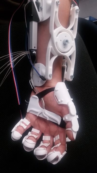 Unikat-Orthese-Hand-Exoskelett_2